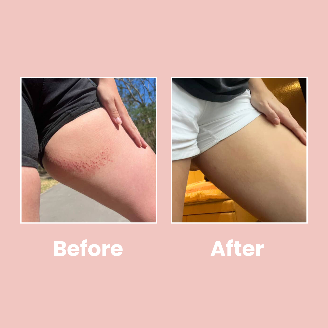 Anti Chafe Stick